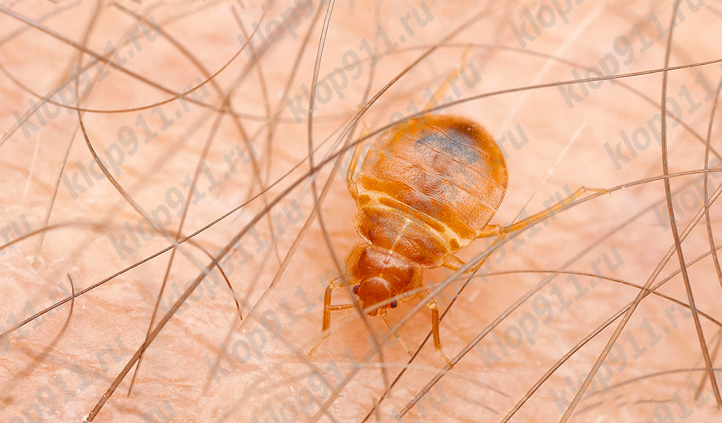 Bed bug on human skin