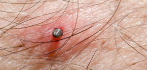 Hur en fästing biter: detaljer om processen när den gräver sig in i huden
