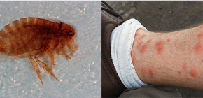 Những điều quan trọng cần biết về bọ chét cát ở Việt Nam và Thái Lan