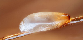 Làm thế nào để loại bỏ trứng chấy khỏi tóc đúng cách: mẹo thực tế