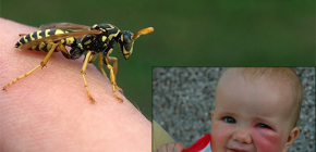 Cosa fare se un bambino viene improvvisamente morso da una vespa