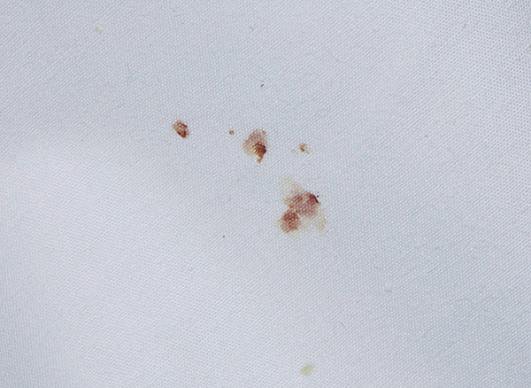Vết máu trên khăn trải giường