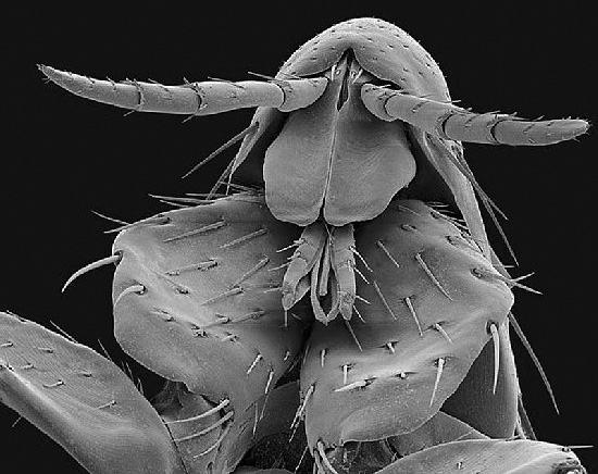 Mänsklig loppa under ett mikroskop