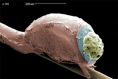 Fotografia unui păduchi de cap la microscop electronic