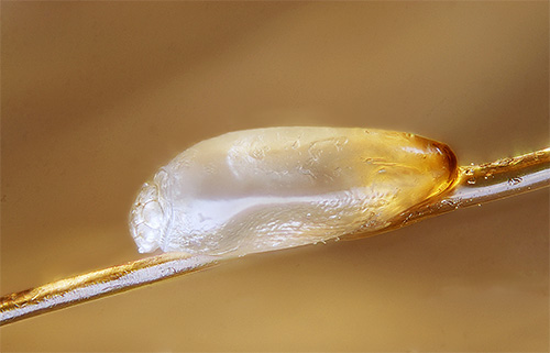 Jaja ušiju u ljepljivom omotaču nazivaju se gnjide.