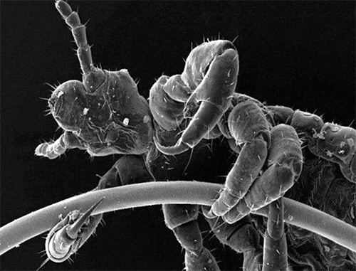 Fotografi av en huvudlus under ett mikroskop