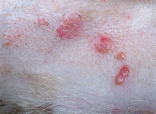 Pyoderma (luka kulit bernanah) disebabkan oleh gigitan kutu katil