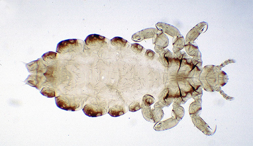 Larva lidské vši pod mikroskopem