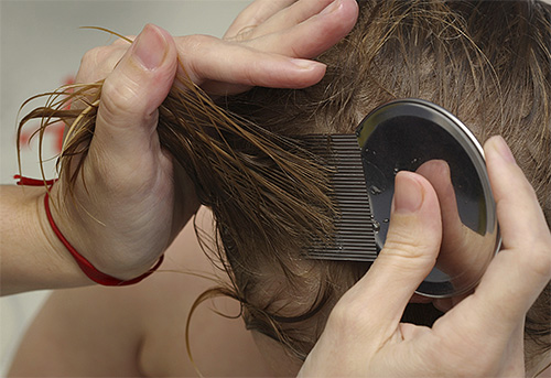 Con l'aiuto di speciali pettini dai pidocchi, puoi rimuovere efficacemente le lendini dai capelli