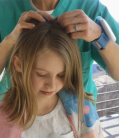 Ako pregled pokaže da na djetetovoj glavi postoje uši, ne oklijevajte ih ukloniti. Ali koji je najbolji način za to?