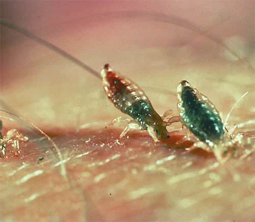 Lichaamsluizen proberen tijdens een beet hun kop in de huid te steken.