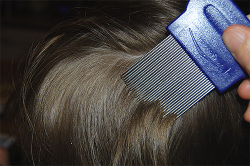 Σε θερμοκρασία +42 βαθμών, οι ψείρες είναι τόσο εξασθενημένες που είναι εύκολο να τις χτενίσετε αργότερα από τα μαλλιά.