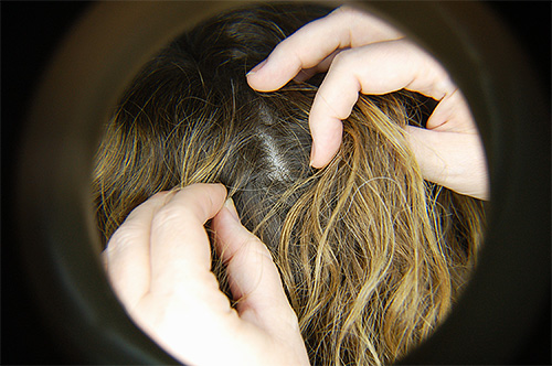 정기적인 모발 검사는 머릿니 감염을 조기에 감지하는 데 도움이 될 수 있습니다.