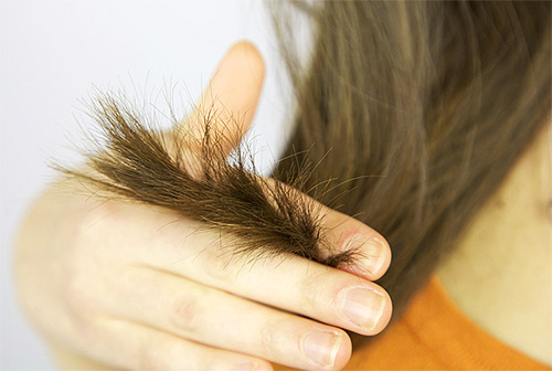 Pokud se ocet použije nesprávně, může poškodit vlasy a pokožku hlavy.