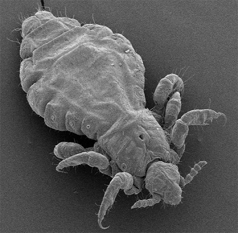 Elektron mikroskobu altında bir baş biti böyle görünüyor