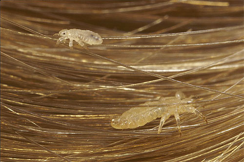 Uši na kosi - najčešća slika ovih parazita u snovima