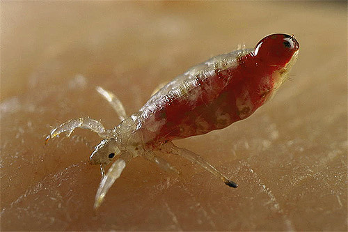 Een luis tijdens een beet: je kunt zien dat de buik van de parasiet gevuld is met bloed