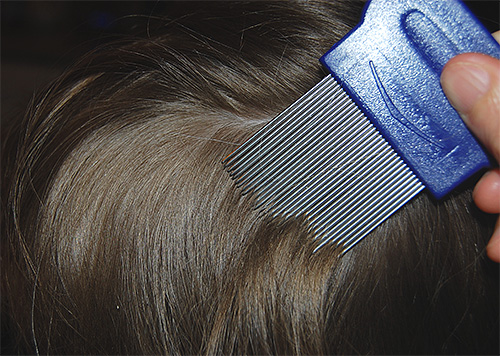 Speciální kovové tvrdé hřebeny umožňují efektivně odstranit z vlasů živé i mrtvé vši a hnidy