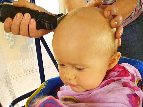 Radersi i peli della testa è ancora il modo più efficace e veloce per sbarazzarsi di pidocchi e lendini.