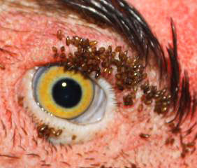 På bilden - ett kluster av kycklingloppor runt fågelns ögon