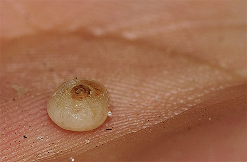 Bilden visar tydligt kroppen av en sandloppa svullen från ägg