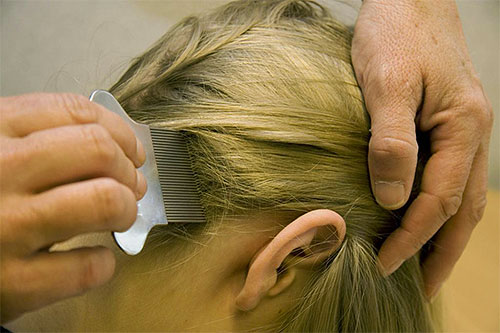 Οι ψείρες και οι κόνιδες χτενίζονται από το σκέλος των μαλλιών.