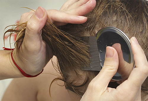 Bij gebruik van een luizenkam moet het haar van het kind zorgvuldig worden gekamd, lok voor lok.