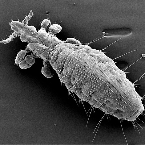 De foto toont een hondenluis onder een microscoop.
