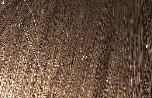 Witachtig gekleurde neten zijn vooral merkbaar op donker haar.