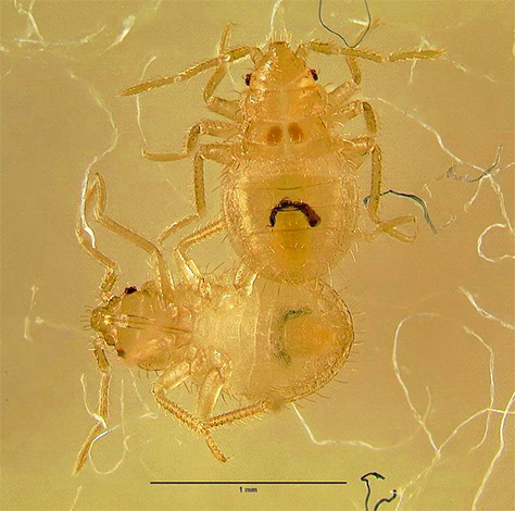 Fotoğraf, mikroskop altında bir tahtakurusu larvasını (perisi) göstermektedir.