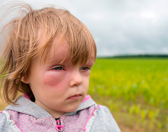 Bij het verlenen van eerste hulp aan een kind moet er rekening mee worden gehouden dat veel allergiemedicatie niet bedoeld is voor gebruik in de kindertijd.