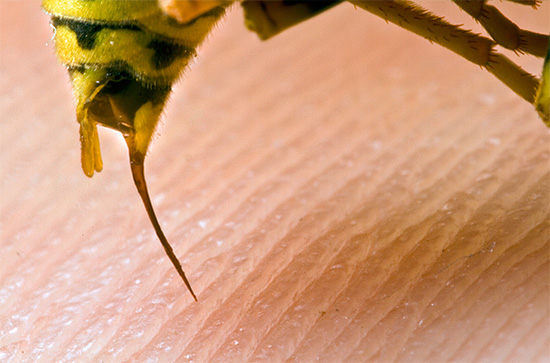 La foto mostra una puntura di vespa: un insetto può usarla più volte in un attacco.