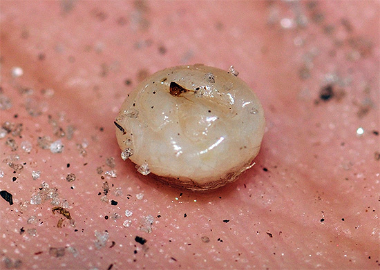 Dan ini adalah bagaimana seekor kutu pasir betina, penuh dengan telur, diekstrak dari bawah kulit, kelihatan seperti.