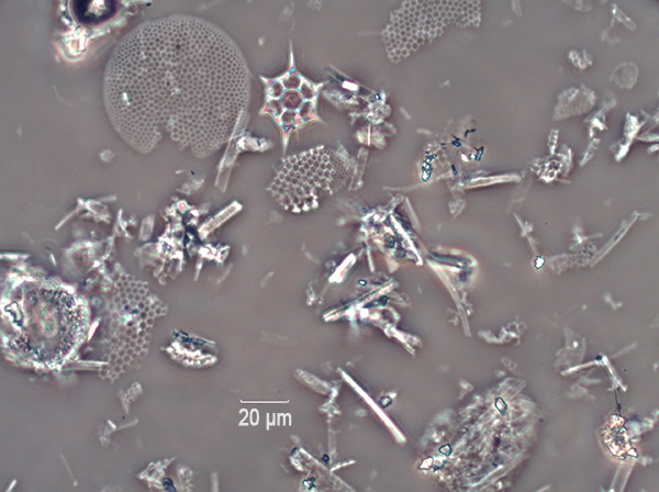 De foto toont deeltjes diatomeeënaarde onder een microscoop.