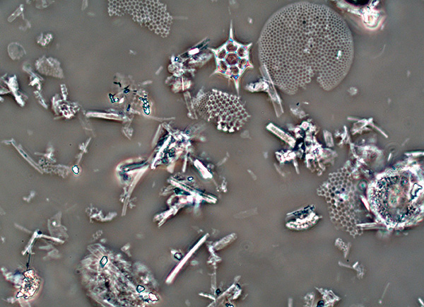 Zarah diatomit di bawah mikroskop.