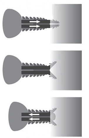 Slika shematski prikazuje rad ustnog aparata tajge krpelja tijekom ugriza.