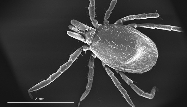 Fotografia unei căpușe de taiga la microscop electronic.