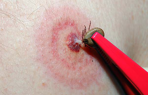Hoe langer de parasiet bloed zuigt, hoe meer speeksel het in de wond afscheidt (vaak bevat speeksel ziekteverwekkers van gevaarlijke ziekten bij mens en dier).