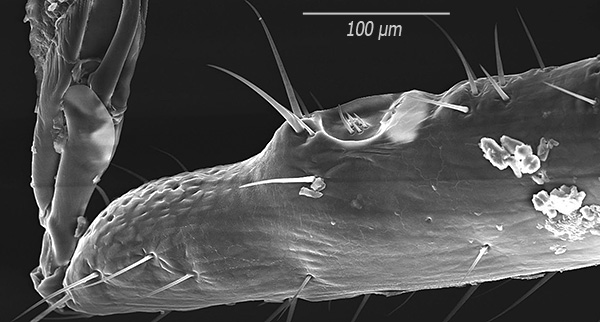 Ve sivri uçlar yüksek büyütmede bu şekilde görünür (resim bir taramalı elektron mikroskobu kullanılarak çekilmiştir).