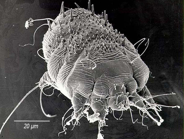 Deze parasiet leeft in de dikte van de huid, maakt hier passages en voedt zich met de opperhuid.