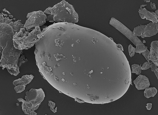 Elektron mikroskobu altında bir toz akarı yumurtası böyle görünüyor.