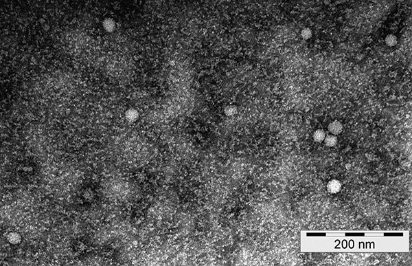Ecco come appaiono le particelle del virus dell'encefalite trasmessa da zecche al microscopio elettronico.