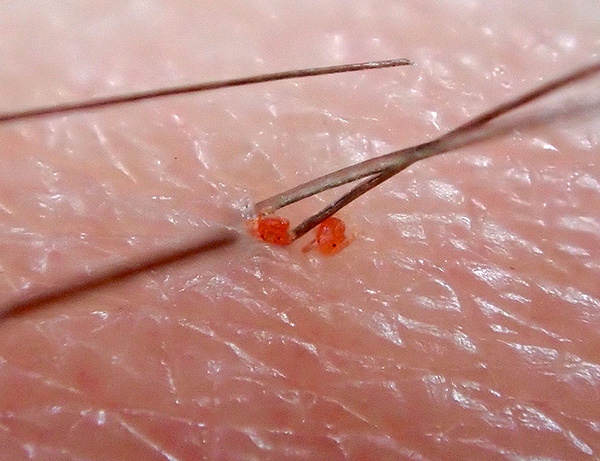 Larva hama kumbang merah juga menggigit orang, memakan darah.
