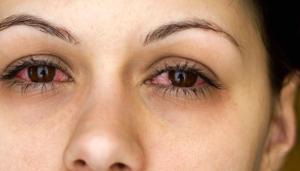 โรคเยื่อบุตาอักเสบจากจมูกสามารถเกิดขึ้นได้เนื่องจากมีไรฝุ่นอยู่ในบ้าน