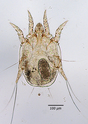 Otodectes cynotis pod mikroskopem, dospělý