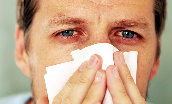 Az orrfolyás, az orrdugulás és a könnyező szem tipikus tünetek, amelyek akkor jelentkeznek, ha az allergén a felső légutak és a szem nyálkahártyájára kerül.