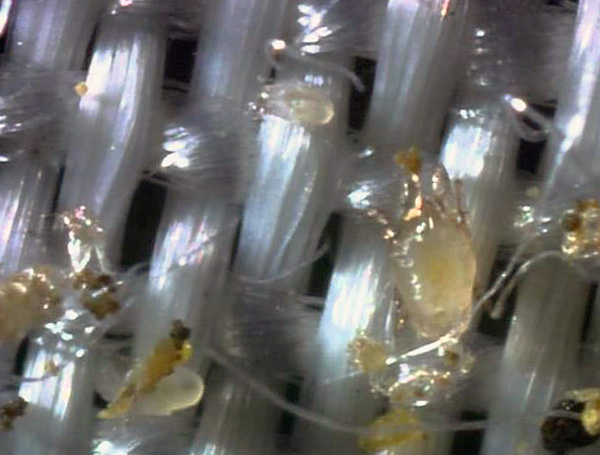 Η φωτογραφία δείχνει δερματοφάγα ακάρεα ανάμεσα στις ίνες των ιστών.