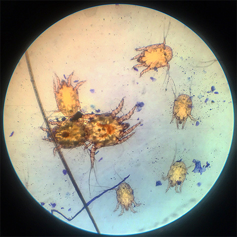 Takto vypadají ušní roztoči pod mikroskopem
