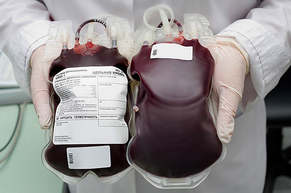 Immunglobulin erhålls från blodplasma från donatorer.