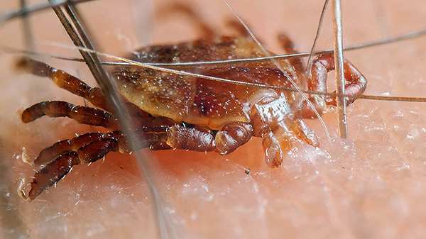 Infectie is alleen mogelijk met de beet van een parasiet, en als het net door de huid is gekropen, is het veilig.